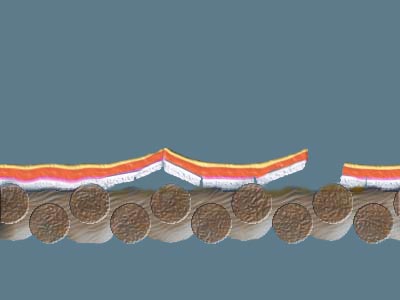 tenting, lifting up of paint from a textile support into a tent shape caused by shrinkage